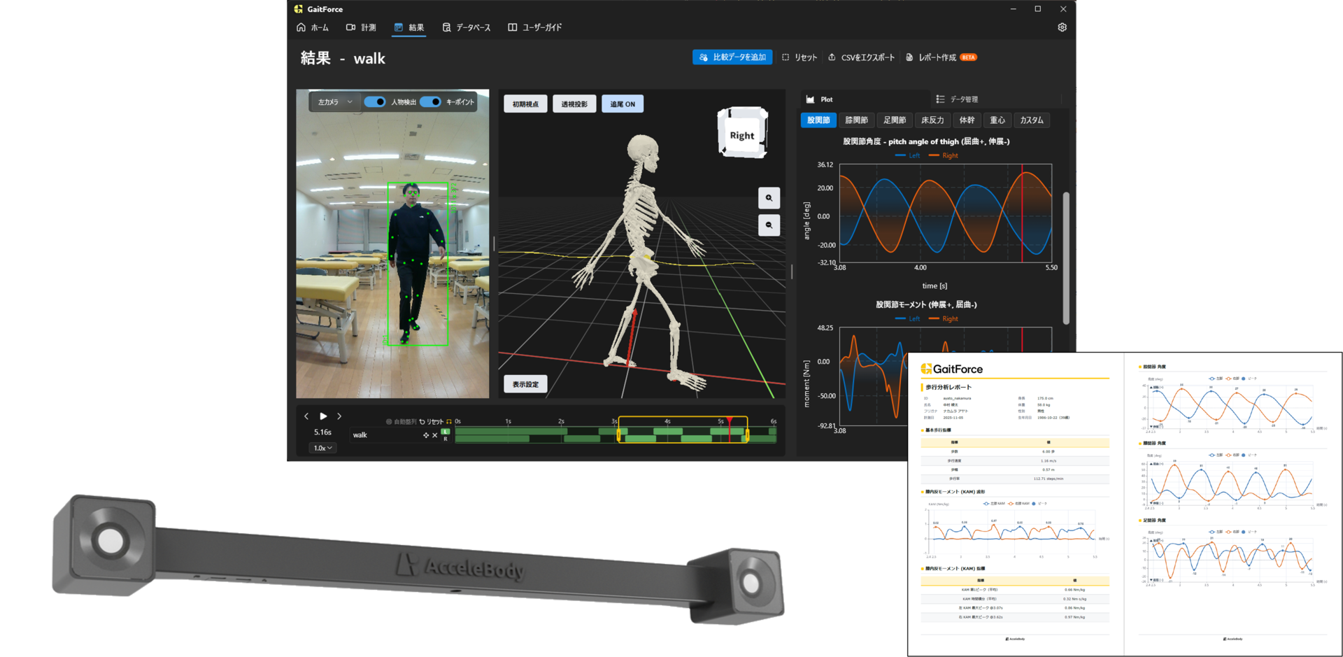 GaitForce の解析画面
